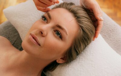 Acupuncture